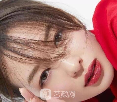 割双眼皮微创好还是全切好？戳进来康康哪种适合你！