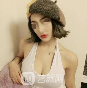 影响隆胸价格的要素有什么?