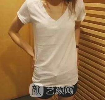 影响隆胸价格的要素有什么?