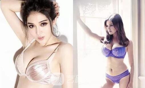 妙桃假体隆胸手术优势