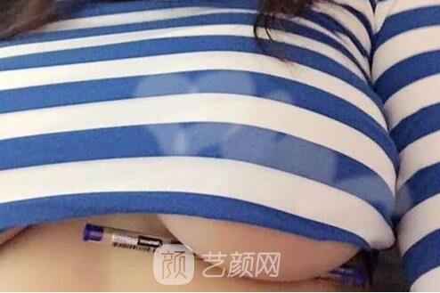 假体隆胸术后一定要做好护理工作哦!