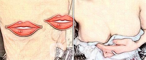 假体隆胸会痛疼吗?造成痛疼的缘故有什么?