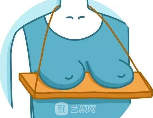 乳房下垂了应该怎么办？挽救方法公开！