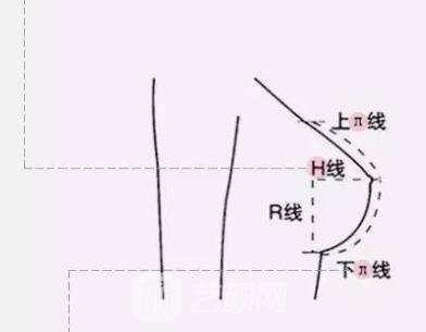 胸部下垂的解决方法?