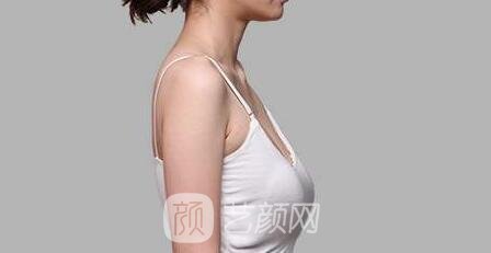 乳房下垂是谁的错？应该如何拯救下垂的乳房？