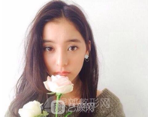 眼部微整形：重睑术+祛除鱼尾纹+祛眼袋，要不要来一套！