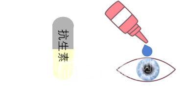 眼部整形后如何护理