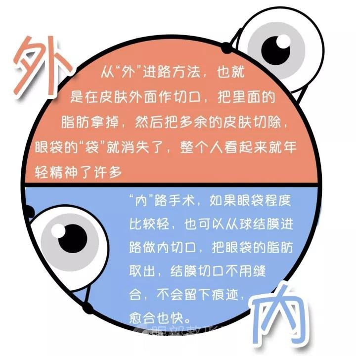 去眼袋手术哪种比较好