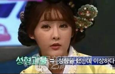 双眼皮手术自然才好看