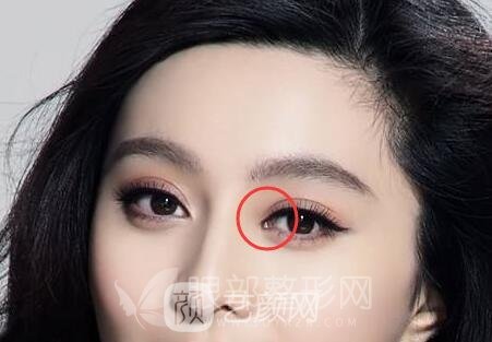 开眼角果好不好