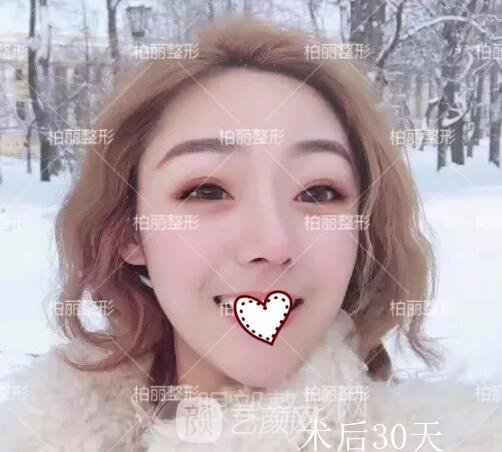 开眼角果好不好 多久恢复?