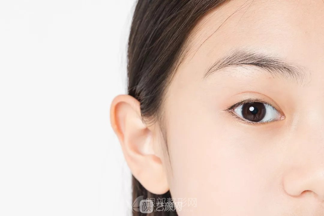 高分子双眼皮轻松让你变成女神,成为人群中较靓的那一个!