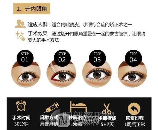 眼角开的过大,还能不能修复自然一点?