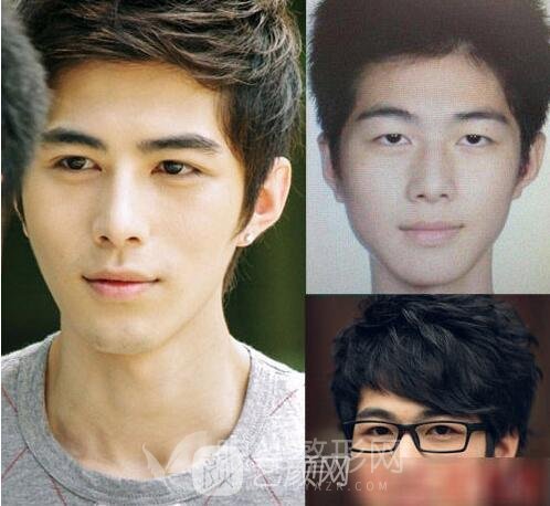 明星也喜爱拉双眼皮手术