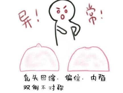 乳腺结节良性和恶性的区别