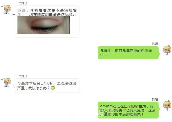 做双眼皮只需要选对医院、医生？术后护理事项同样重要！