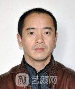 戴三友双眼皮案例 恢复果还是很不错的
