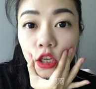 李宇正牙失败案例有吗?没有就看看那我的真实案例吧!