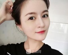 下颌角接骨整形技术靠谱吗？来看个真实案例
