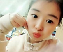 北京京民医院整形科郭建玲医生技术是真的好!看我的双眼皮完全微创!