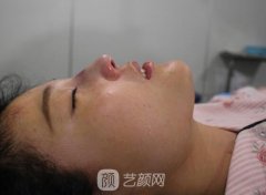 硅胶垫鼻梁性价比太高了，【果图】难怪那么多人喜欢!