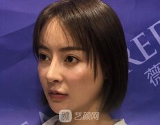 除皱吗？自一个奔四女人的自述