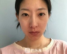 去黑头黑脸娃娃有果吗？什么时候可以看出果？