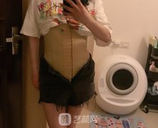 自从做了360溶脂减肥，从此都可以进入模特界啦！