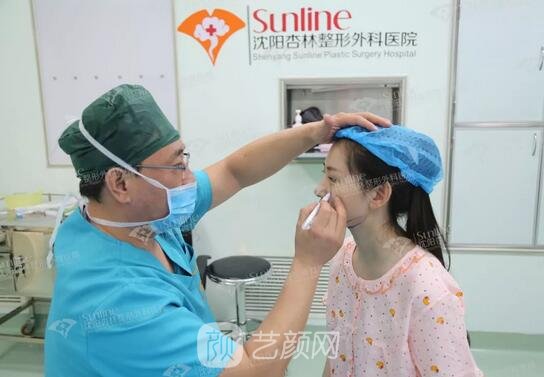 沈阳杏林张宇夫鼻部手术案例