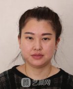 快速去双下巴之后，终于又能站在舞台上了