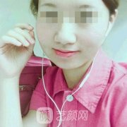 大连附属二院美容科真实恢复果图