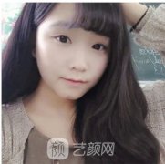 隆鼻贵?玻尿酸隆鼻了解一下，2999你值得拥有!