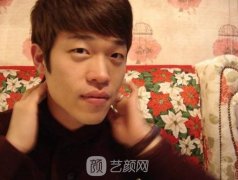 男士下颌角整形过程和术后照片，本不帅的我有点小帅了