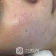 带头风范嫩肤让我多年的色斑没有啦，皮肤更光滑细腻了