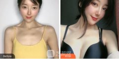我做了隆胸d罩杯，直接从飞机场化身喜马拉雅山脉又大又挺!!