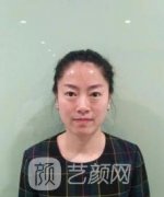 亲自体验后分享：光子嫩肤后注意事项，第一次医美小总结！