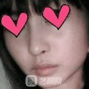 上海市第九人民医院整形科下颌角案例实际果图