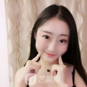 广州南方医院整形科抽脂瘦脸案例