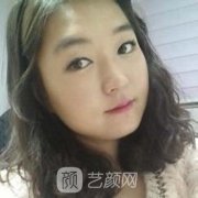 哈医大四院整形美容科下巴整形案例