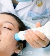 热玛吉紧肤价格是多少？除皱果好吗？