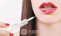 胶原蛋白丰唇价格是多少？优势有哪些？