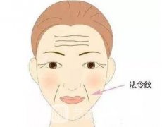 法令纹是哪里的皱纹？成因是什么？