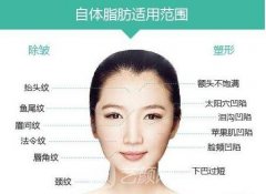 面部填充整容价格是多少？没问题吗？