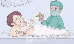 抽脂价目表一览，附大腿抽脂照片