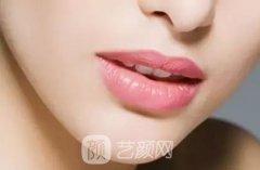 厚唇改薄整形手术价格是多少？手术风险大吗？