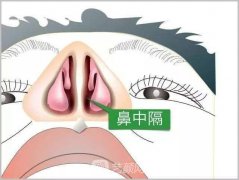 鼻中隔偏曲手术费用一般多少钱？价格贵吗？