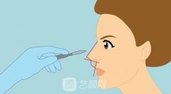 肋骨鼻部手术价格大概多少？包括哪些项目？