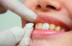 牙齿整形有年龄规定吗？什么时候进行牙齿整形矫正更好呢？