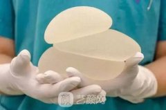 假体隆胸多大好看？有没有具体的标准？