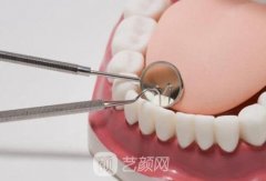 门牙烤瓷贴面很容易掉吗？多少钱一颗？